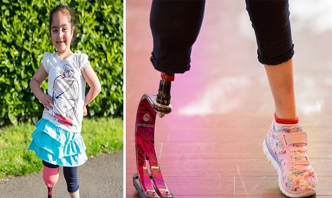 Viral and Trending Video of Anu a little girl from London with prosthetic sports blade