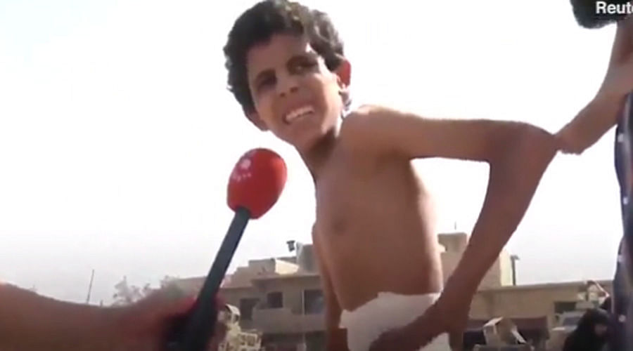 No water, No Food, Injured Iraqi boy hid for 20 days in Mosul basement and now rescued