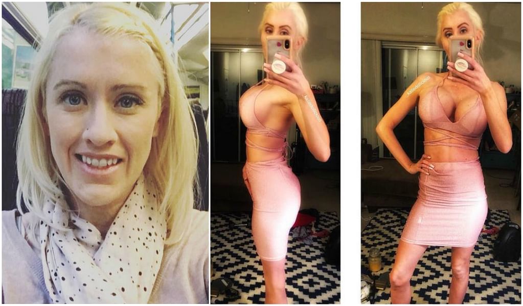 Katie Rose a real life fighter of cancer now looks like a barbie doll
