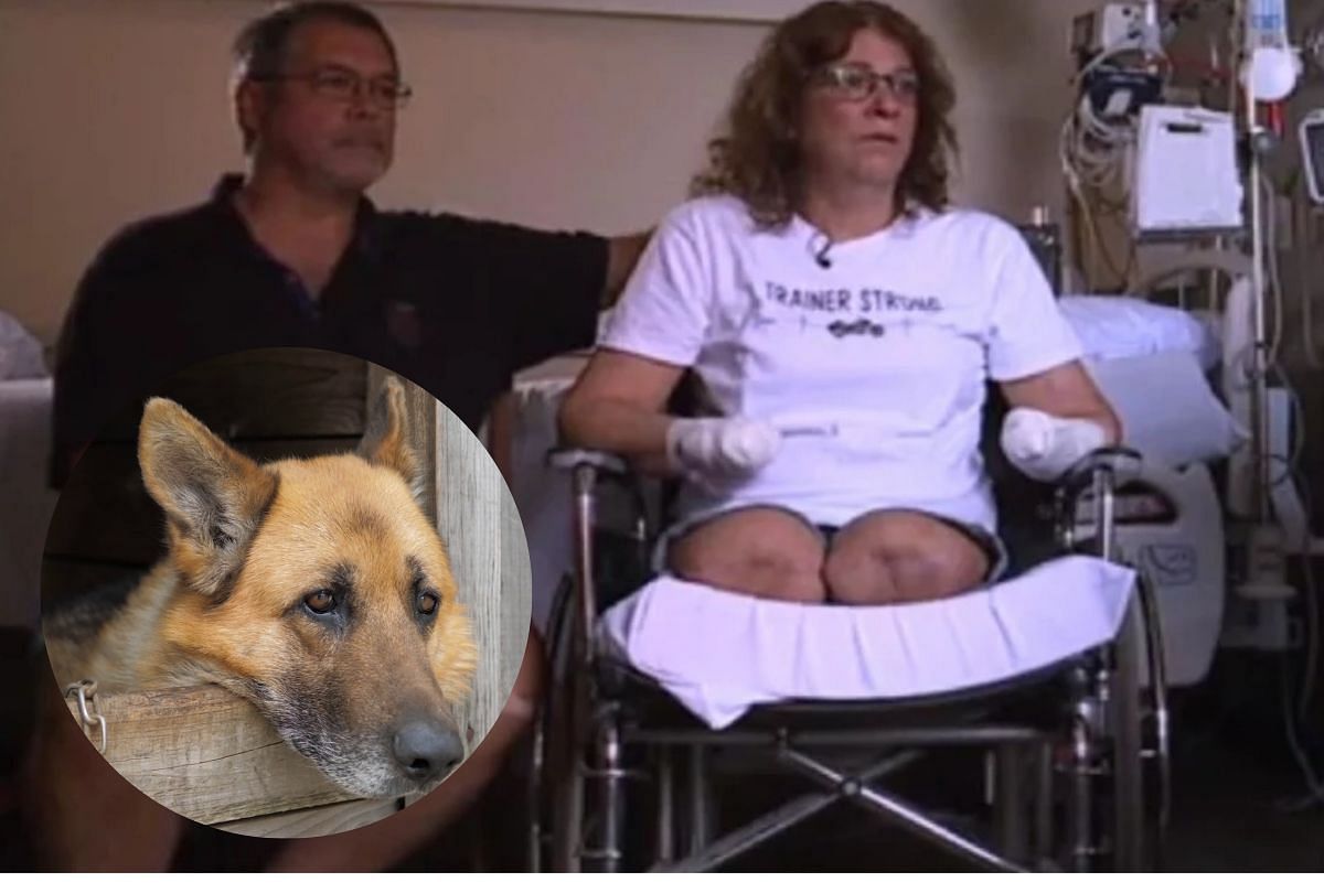 american woman lost her hands and legs due to infection from dog kisses