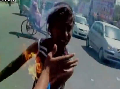 ओवैसी का पुतला जला रहा युवक आग की चपेट में आया, खुद जला Protest of ABVP Against Asaduddin Owaisi