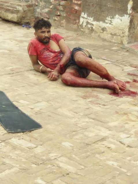लड़कियां छेड़ता था तो सड़क पर तड़पा-तड़पा काटे हाथ-पैर, मौत Villagers cut man's hands and feet, punjab bathinda news