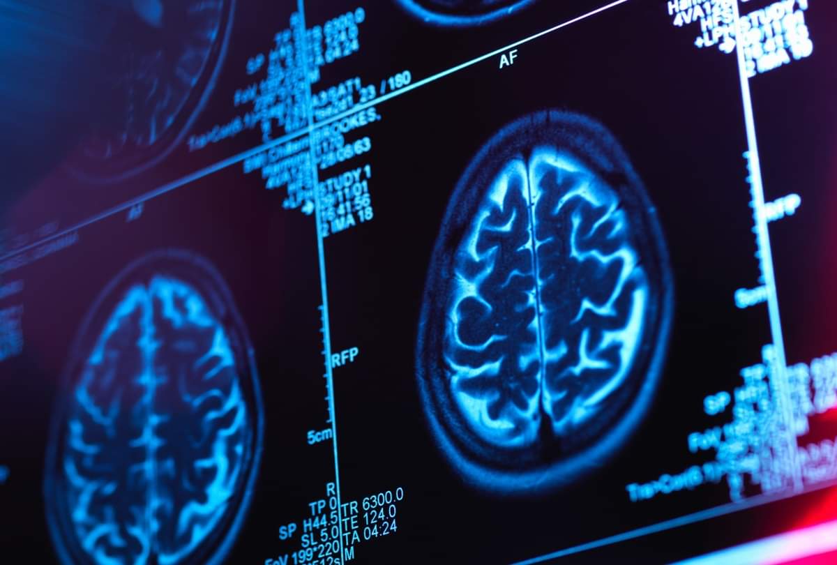 सावधान: कोरोना संक्रमितों में देखे जा रहे हैं यह न्यूरोलॉजिकल लक्षण, कहीं आपको भी तो नहीं है ऐसी कोई परेशानी? these neurological symptoms are seen in the covid infected