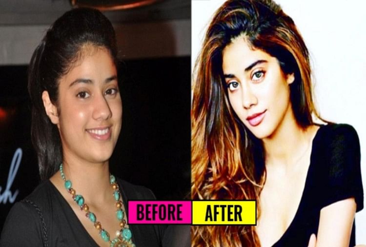 List Of Bollywood Actresses Who Have Had Plastic Surgery Amar Ujala Hindi News Live