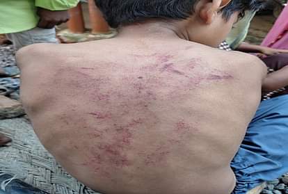 प्रतापगढ़ : होमवर्क पूरा न करने पर उर्दू शिक्षक ने मासूम बच्चे को बेरहमी से पीटा, शिक्षक के खिलाफ पिता ने थाने में दी तहरीर Pratapgarh: Urdu teacher brutally beats innocent child for not completing homework, father complaint police station against teacher