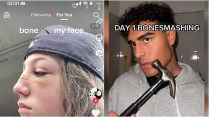 TikTok Trend: टिकटॉक का नया जानलेवा ट्रेंड, हथौड़े से चेहरा तोड़ रहे लोग, हैरान करने वाली है वजह Bone smashing new trend of TikTok people are breaking their faces with hammers know reason