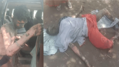 indore news Another worker burnt in the bomb factory fire also died