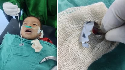 Shahdol: Fifteen month old innocent boy swallowed a blade while playing