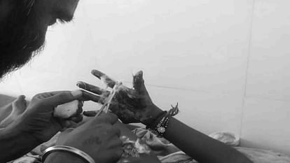 Chhindwara News: Two children injured in mobile phone explosion
