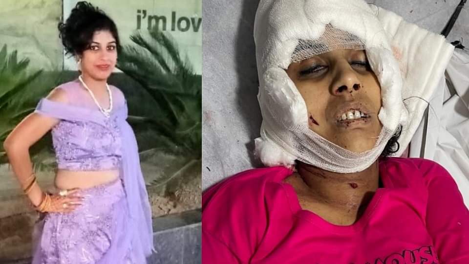 कारोबारी का जानलेवा प्यार: इतनी बेरहमी से मारी गई लिप्सी... डाॅक्टर भी कांपे, सामने आया रात का पूरा सच Murder of woman in Ludhiana