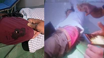 UP: रेस्तरां कर्मी को मारी गोली, खून से लथपथ होकर जमीन पर गिरा...फिर खुद ही बाइक चलाकर पहुंचा थाने restaurant employee shot himself drove his bike to police station