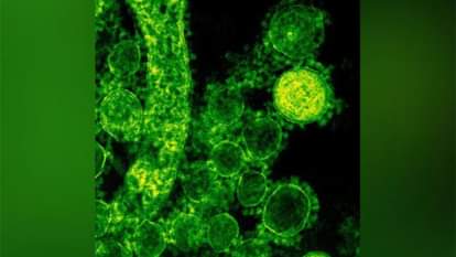 Nipah Virus: निपाह से लड़ने के लिए भारत में बनेंगी मोनोक्लोनल एंटीबॉडी, हर सप्ताह तैयार होंगी एक लाख खुराक India to Produce Indigenous Monoclonal Antibodies Against Nipah Virus; 1 Lakh Doses to Be Made Every Week