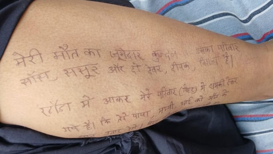 UP: 'मुझे कमरे में बंद करके पीटा... कई दिन भूखा भी रखा', पति ने तलाक मांगा तो हाथ-पैर पर सुसाइड नोट लिख दी जान Husband asked for divorce wife suicide by writing a suicide note on her body In Baghpat