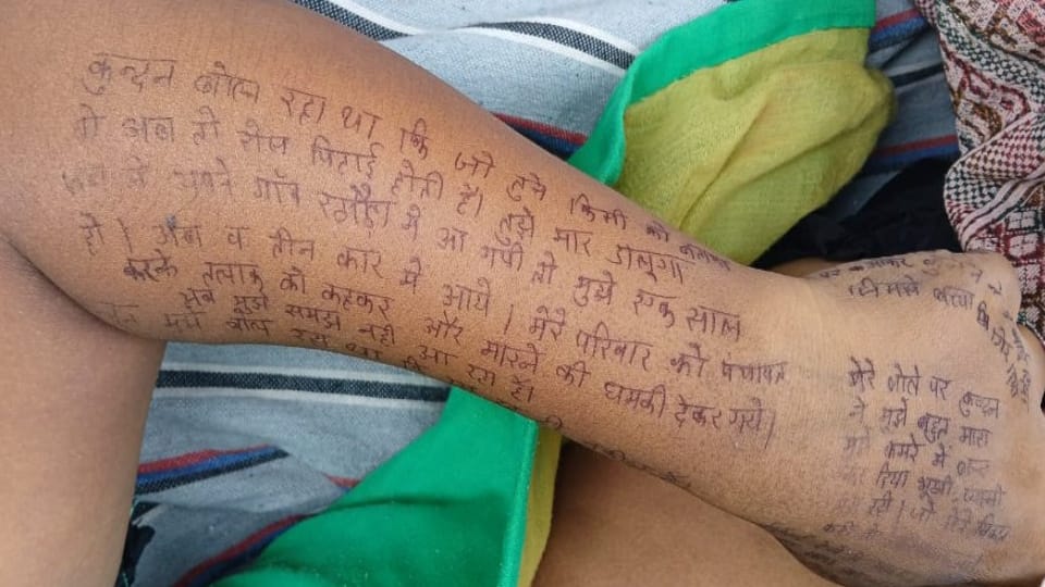 UP: 'मुझे कमरे में बंद करके पीटा... कई दिन भूखा भी रखा', पति ने तलाक मांगा तो हाथ-पैर पर सुसाइड नोट लिख दी जान Husband asked for divorce wife suicide by writing a suicide note on her body In Baghpat