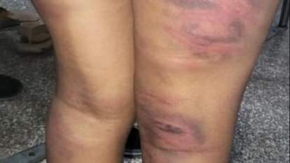 Haryana: मौलवी की क्रूरता... बच्चे को रस्सी से बांध बुरी तरह पीटा, मदरसे पहुंची मां, मासूम को देख फट गया कलेजा Maulvi beats a child in Panipat