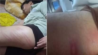 भिवानी में निजी स्कूल टीचर की बेरहमी: दो चचेरे भाईयों को डंडे से पीटा, थप्पड़ बरसाकर मुंह कर दिया लाल Two cousins brutally beaten by a teacher in Bhiwani