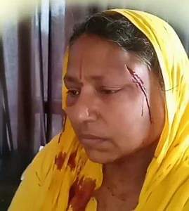 दुस्साहस: घर में घुसकर दबंगों ने महिला को पीटा, वो चीखती रही...नहीं आया रहम; थाने पर भी हुआ ये सुलूक The goons entered the house and beat up the women