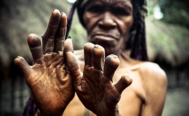 this tribe cuts a woman’s finger When a loved one dies