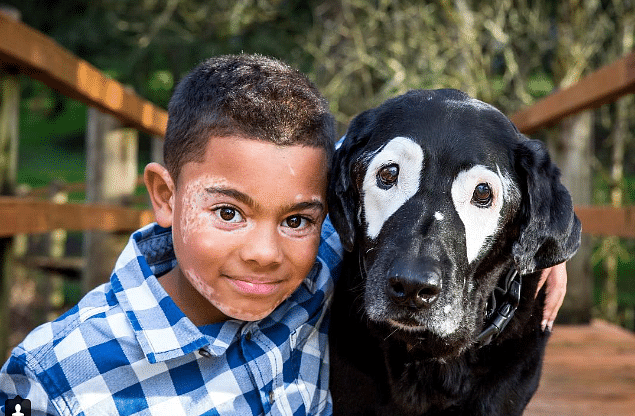 Boy Meets Dog With The Same Skin Condition.