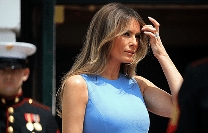 ‘The Melania’ is the hottest trend in plastic surgery