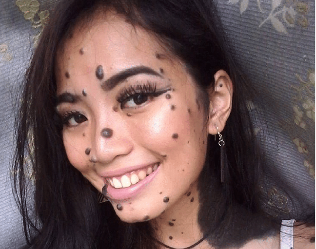 Malaysian Woman Body Covered in Moles is going to next Miss universe 