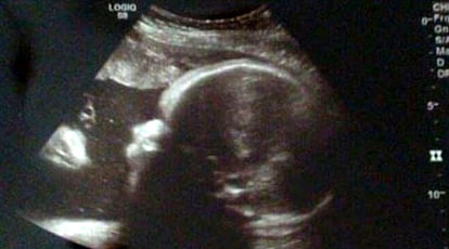 Miracle: Couple 'see JESUS' watching over their baby girl in ultrasound image