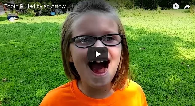 Tooth pulled out with the help of bow and arrow, video goes viral 