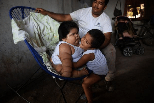 world fattest baby suffers daily struggles checkout photos