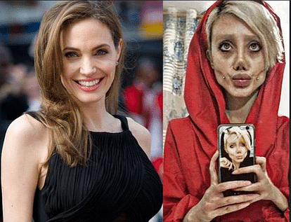 After '50 surgeries' Angelina Jolie lookalike terrifies internet viral pics