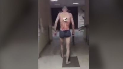 Russian man goes for smoking before operation while knife stab on his back video viral