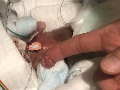 world smallest baby born in japan sent home healthy