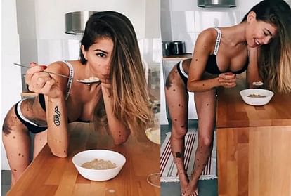 instagram star bikini model yulianna yussef a dalmatian because of birthmark 