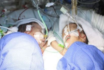 one month after first baby bangladesh 20 years old women give twins baby birth