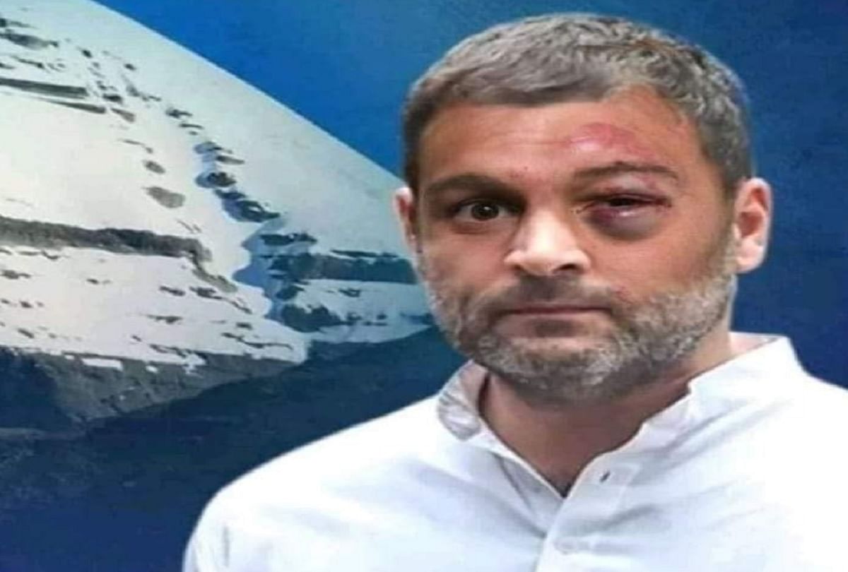 Rahul Gandhi beaten up Fake Pic Viral on Social Media