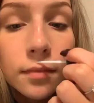 viral video of superglue lip challenge trend on social media