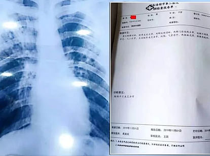 chinese teacher make Fake Tuberculosis report to Get Holiday from school