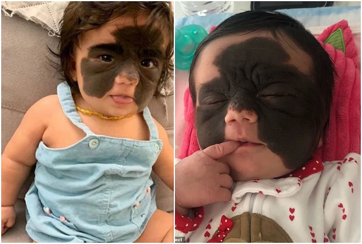 a girl born with batman mask doctor reveal shocking truth