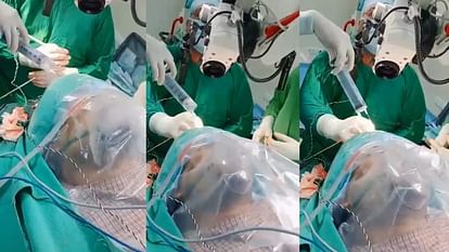 Brain Tumor Surgery Video Viral