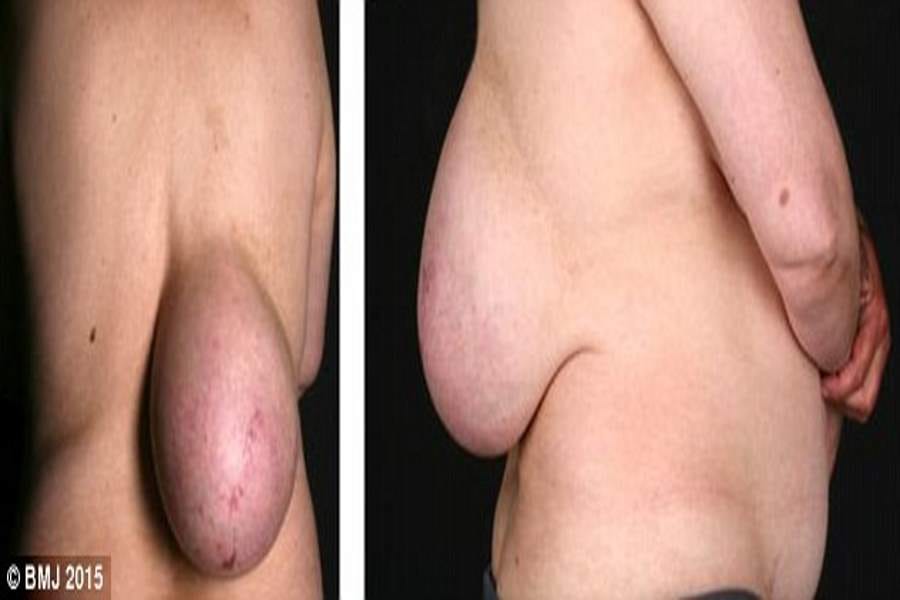 woman with breasts on back