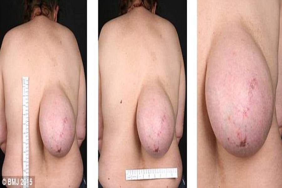 woman with breasts on back