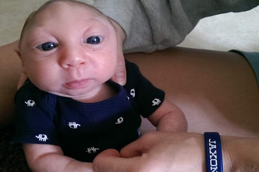 baby with half head