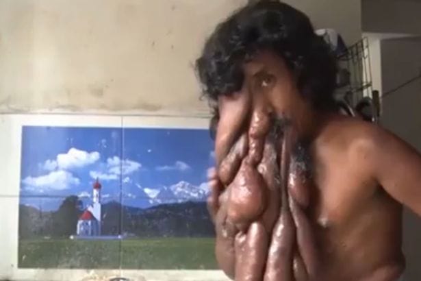 life of kannai at its worst