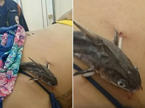 Catfish attack on the girl