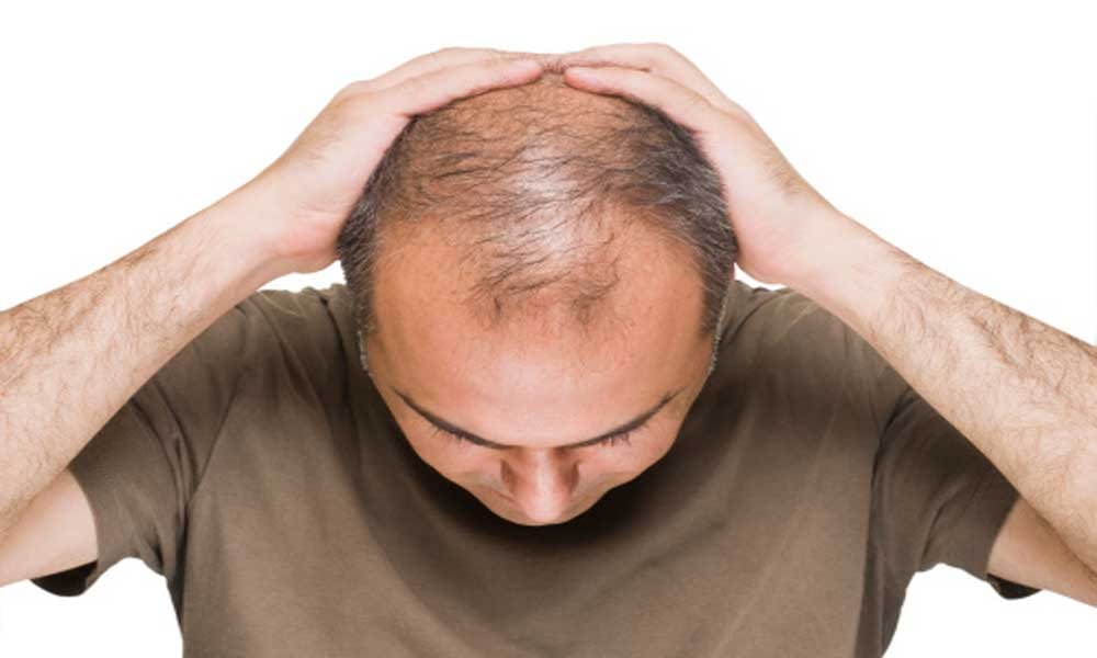 home remedies and therepy to reduce hair fall and baldness