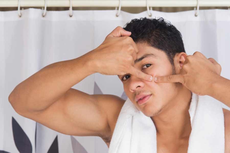 tips to cure blackheads