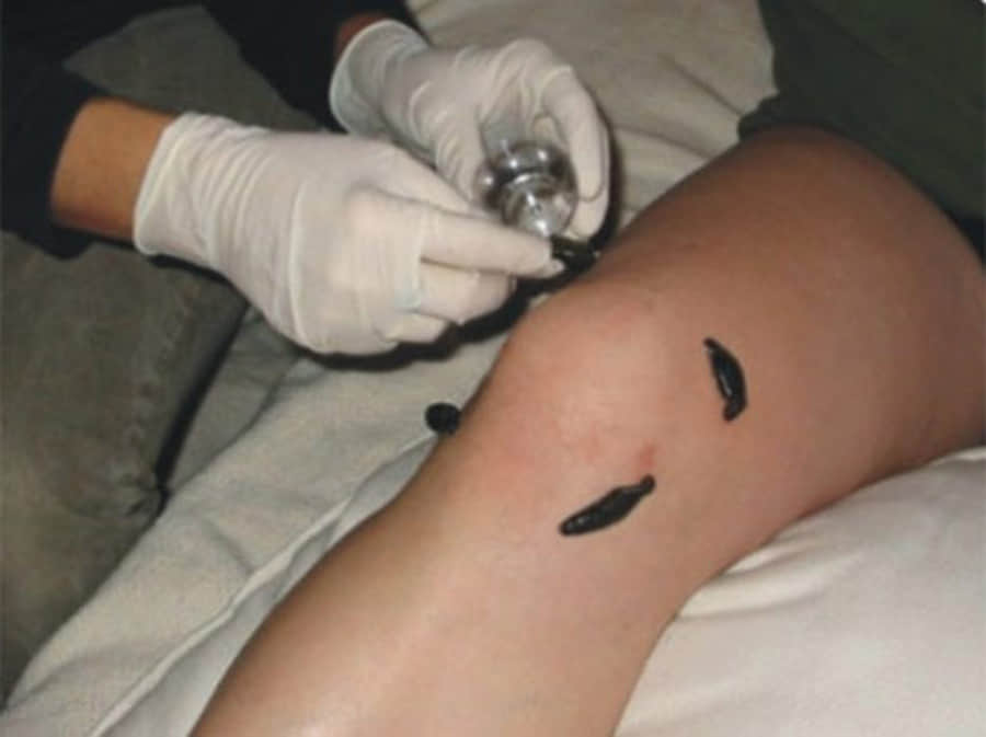 weird massage therapies around the world