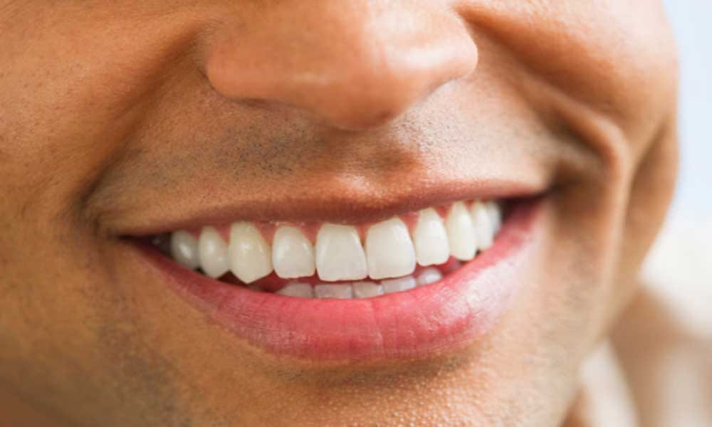 palmistry gap between teeth is lucky 