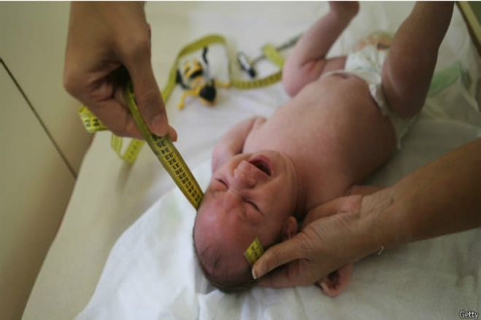 Zika virus kills developing brain cells