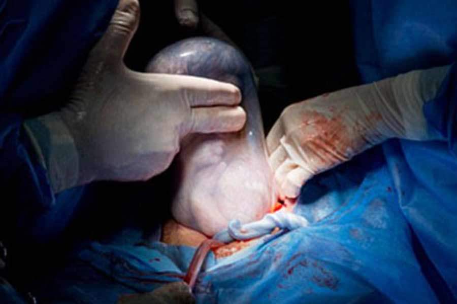 best birth photography 2016