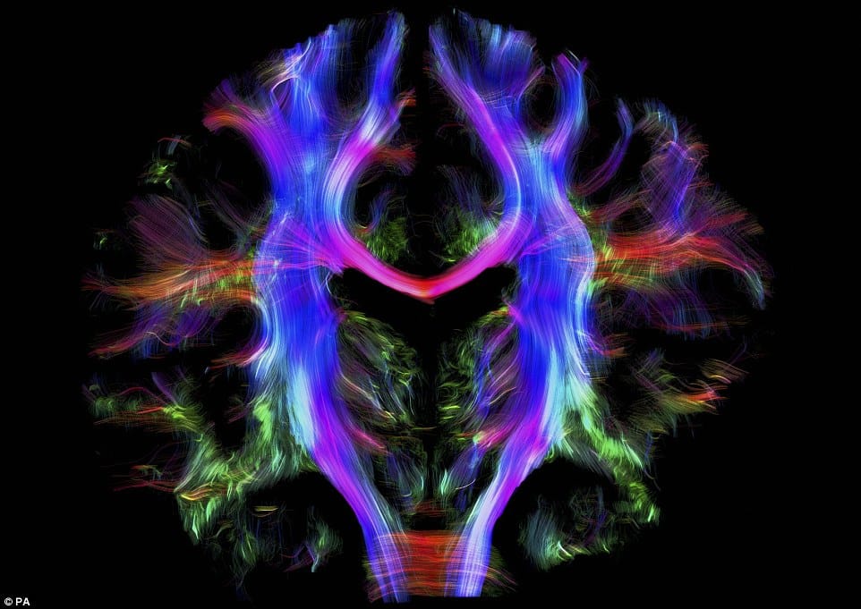 Everything You Need to Know about  Alzheimer's Symptoms and causes